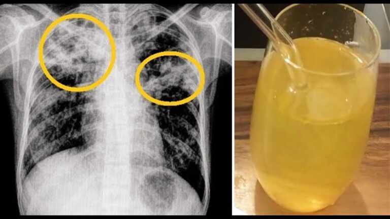 This simple method clears chest mucus fast and helps you breathe easier…