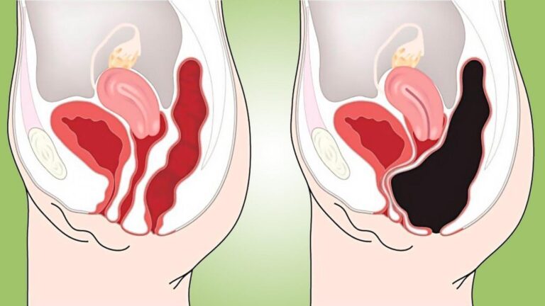 This simple recipe could transform your colon health… you won’t want to miss it!
