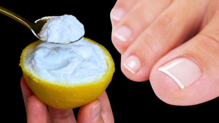This easy solution makes nail fungus vanish like it never existed…