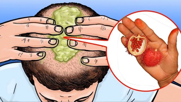 11 Foods for Thicker Hair in Just 7 Days – Discover the Secrets Now!