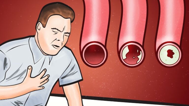 7 Foods to Clean Your Arteries and Prevent Heart Attacks Now!