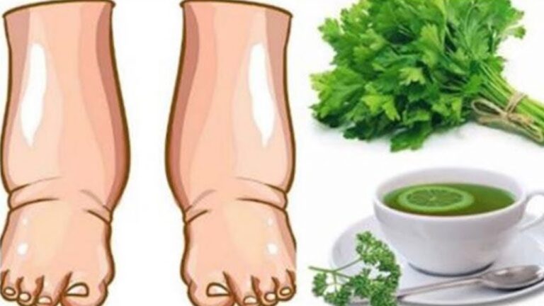 Soothe Your Legs: 5 Days to Relief with This Powerful Homemade Tea