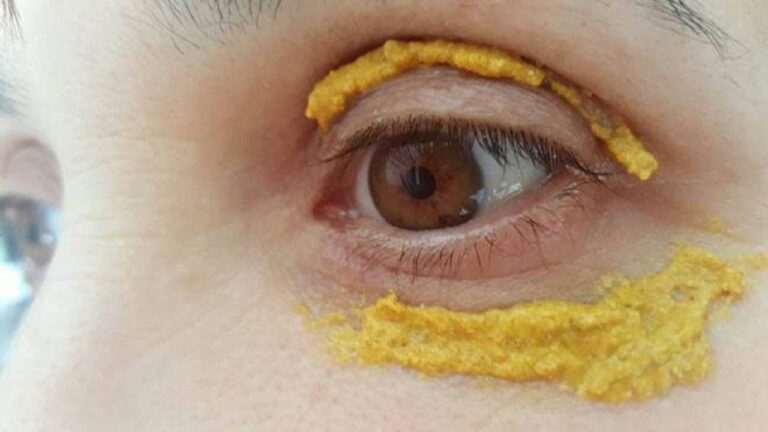 Discover 5 Incredible Benefits of Turmeric for Your Skin in Just 10 Minutes!