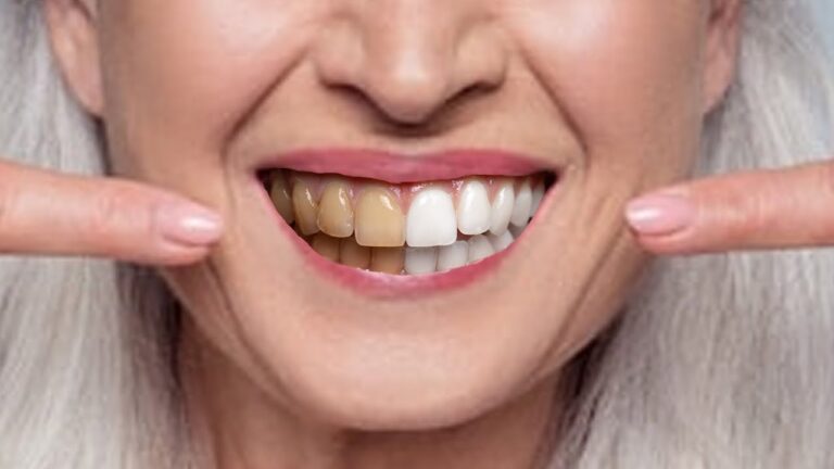 11 Simple Natural Ways to Whiten Your Teeth at Any Age