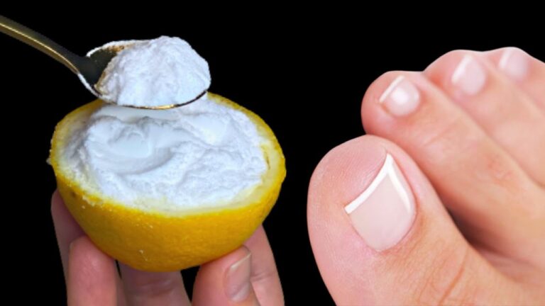 Erase Nail Fungus Fast: 5 Natural Remedies You Need to Try!