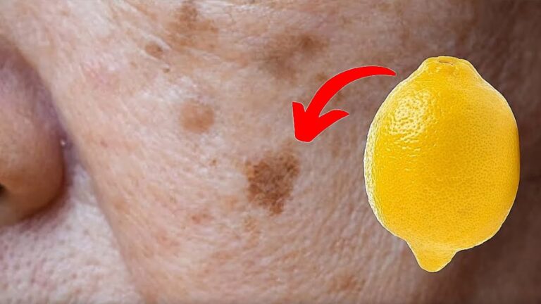 8 Lemon Hacks to Remove Age Spots Naturally and Glow Up Your Skin!