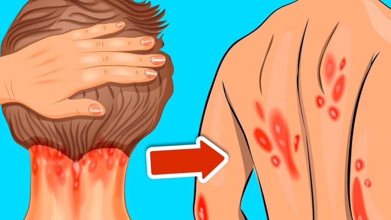 10 Signs You Have a Vitamin D Deficiency You Must Know Now!