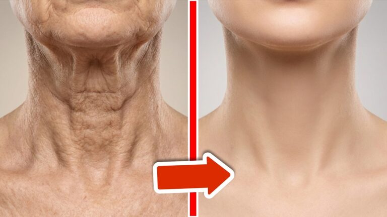 5 Quick Tips to Reduce Neck Wrinkles and Look Years Younger!