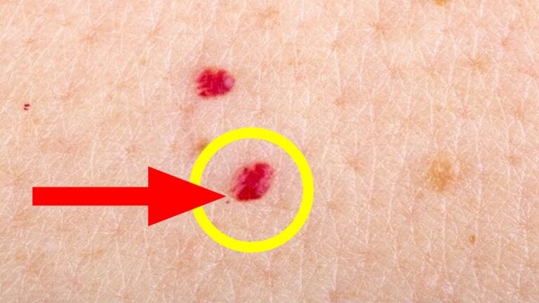 7 Causes of Red Spots on Skin and When to Seek Help for Relief
