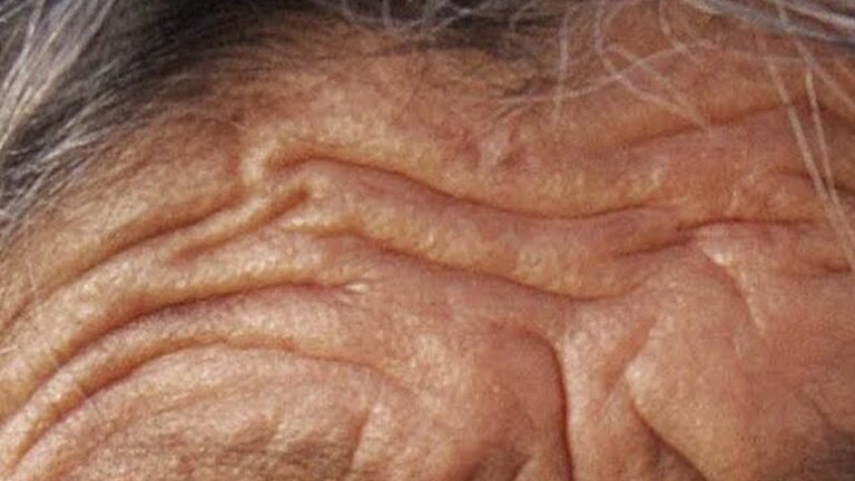 5-Minute Trick to Reduce Wrinkles: See the Amazing Transformation!