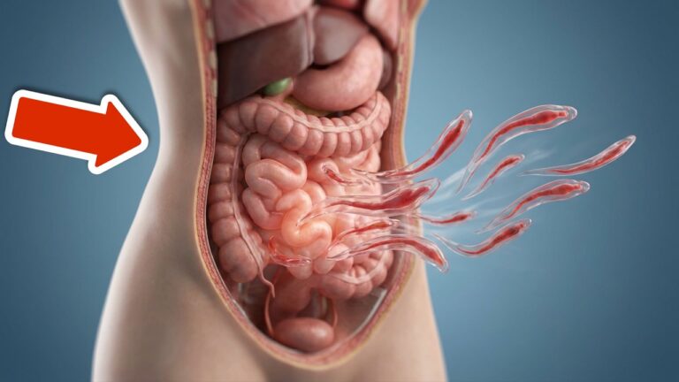5 Fast Ways to Eliminate Intestinal Worms Naturally and Effectively